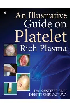 An Illustrative Guide on Platelet Rich Plasma - Dr Sandeep