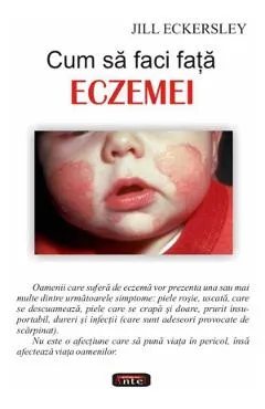 Cum sa faci fata eczemei - Jill Eckersley