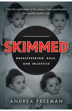 Skimmed: Breastfeeding, Race, and Injustice - Andrea Freeman