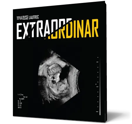 Toulouse Lautrec - Extraordinar